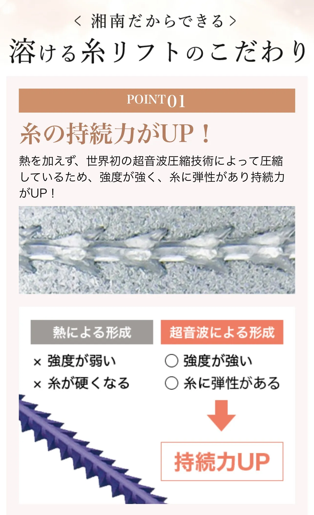 湘南美容クリニックの糸リフトは強度が強く、持続力が高い