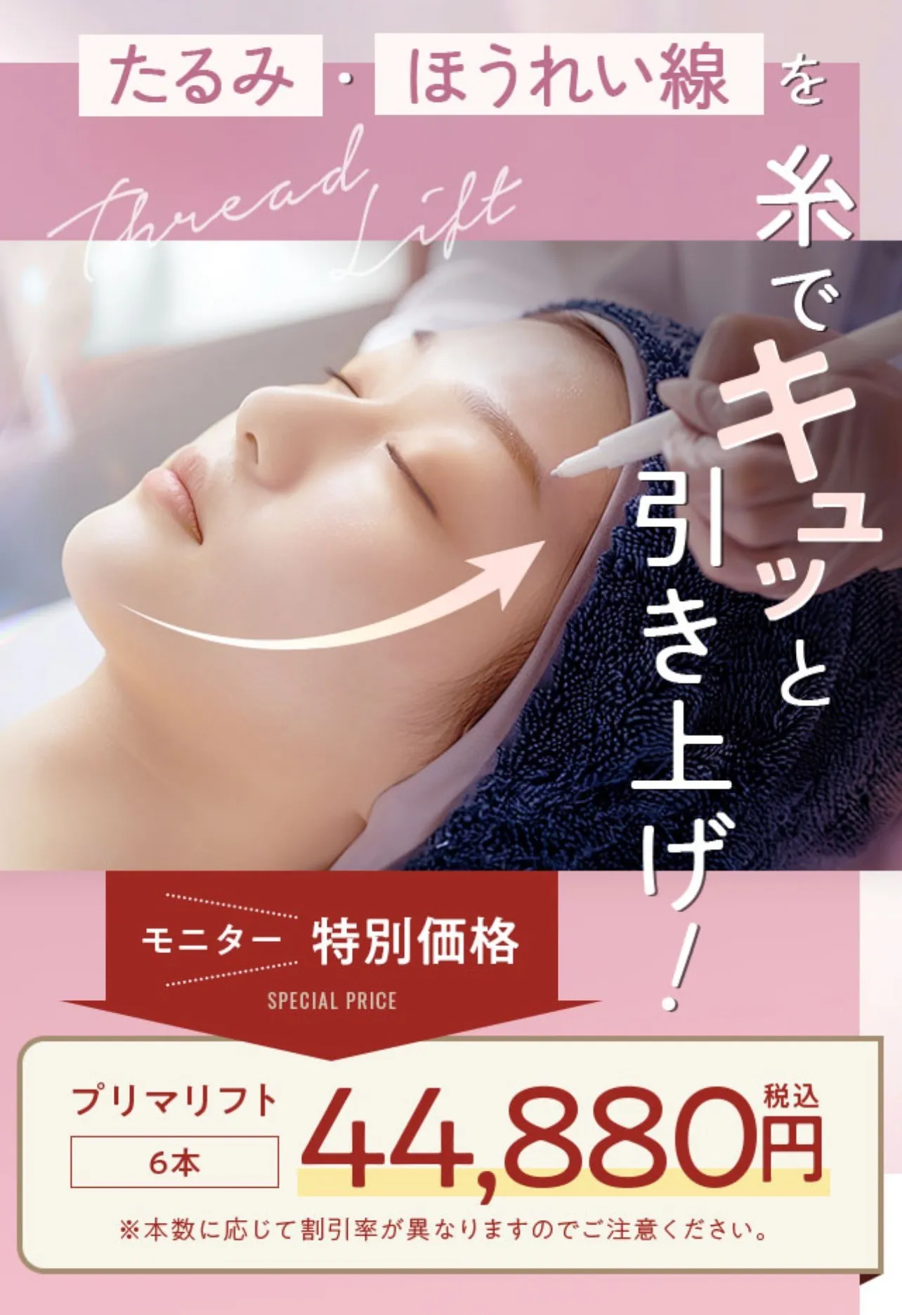 湘南美容クリニックの糸リフト