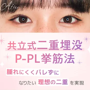 共立美容外科の共立式二重埋没P-PL拳筋法