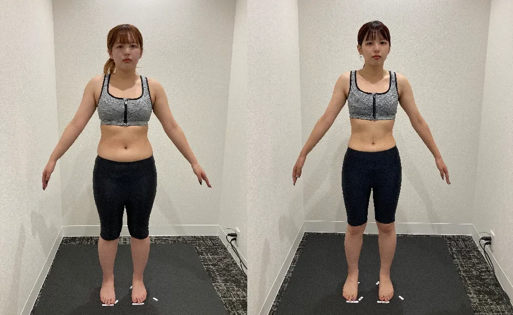 ディオクリニック無料ダイエットモニターの症例