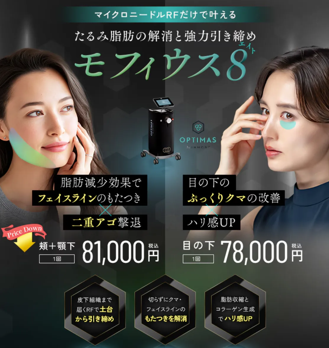 湘南美容クリニックのモフィウス8