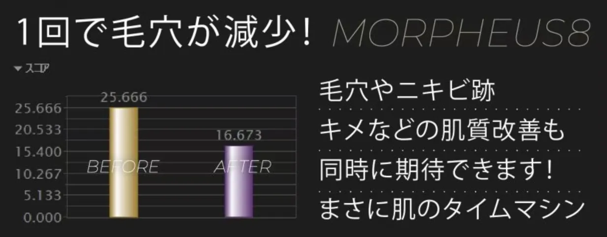 湘南美容クリニックのモフィウス8で施術した後は毛穴が減少