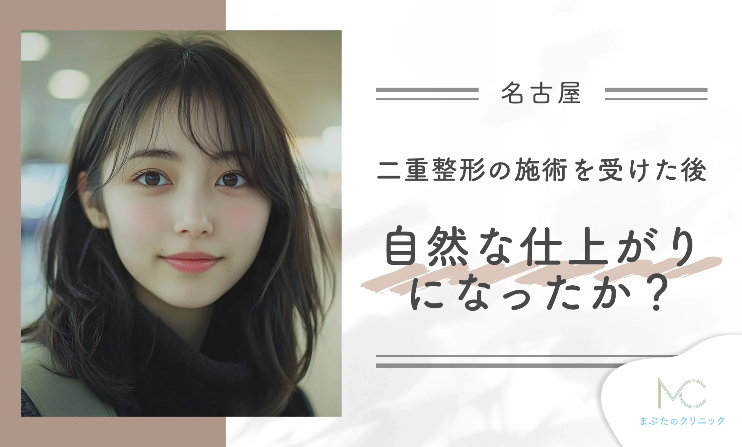 二重整形の施術を受けた後、自然な仕上がりになったか?