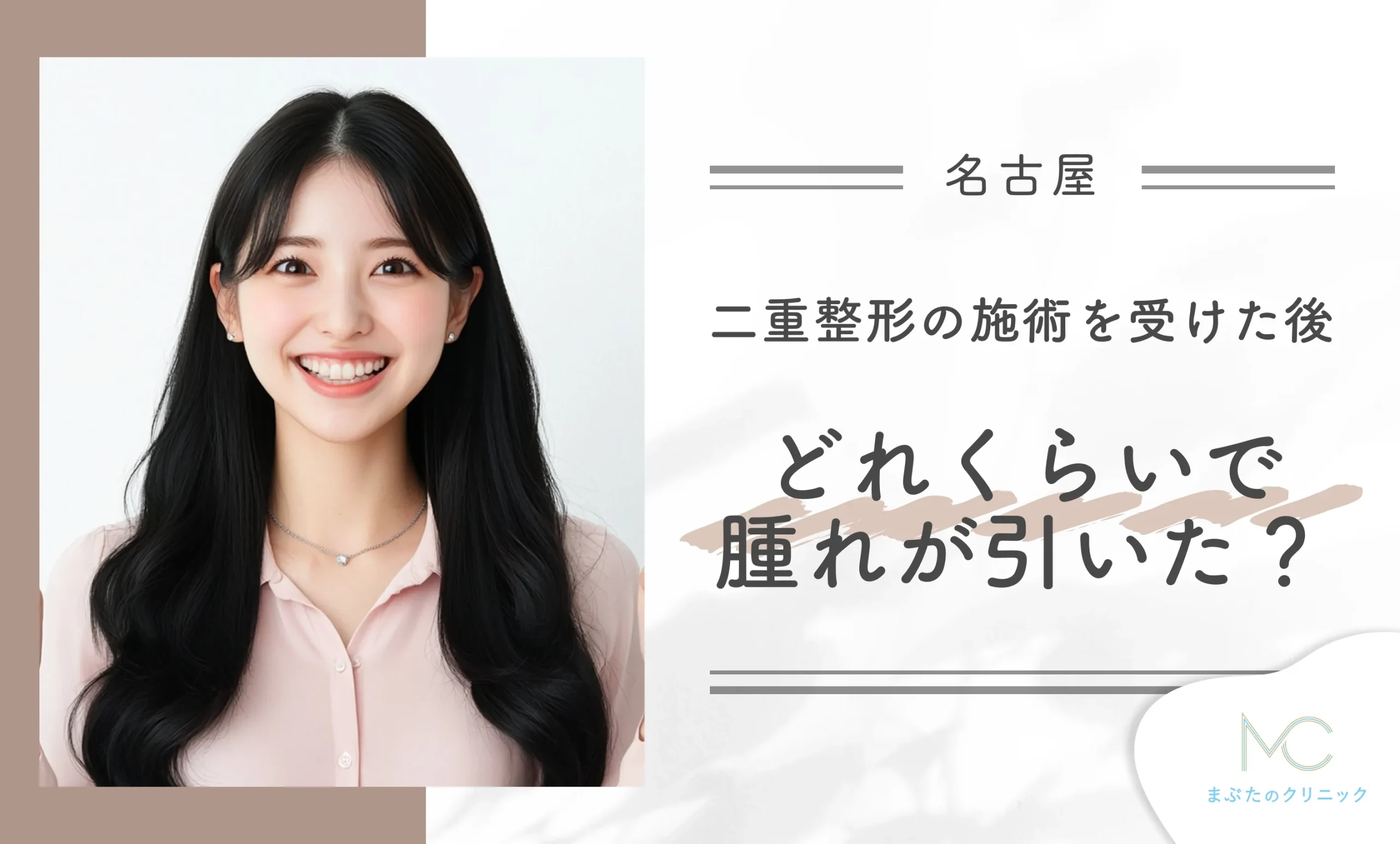 名古屋で二重整形の施術を受けた後、どれくらいで腫れが引いた?
