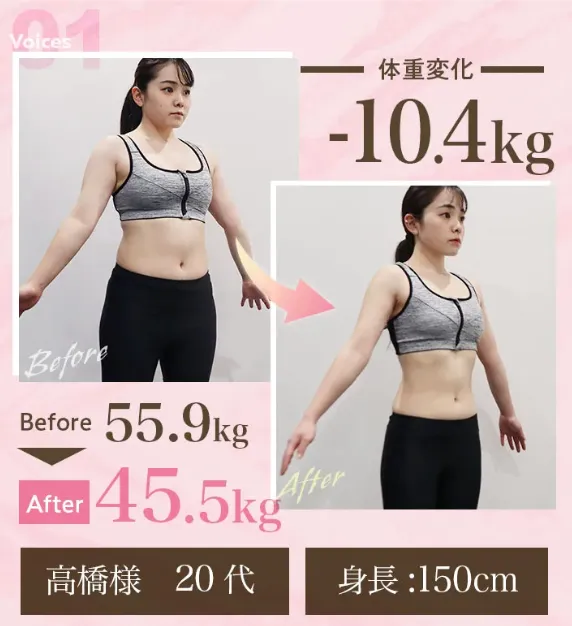 医療ダイエットでおすすめのディオリニックの症例写真