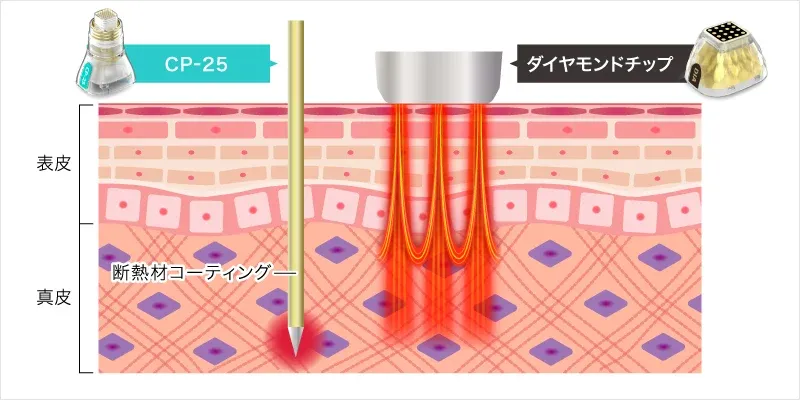 名古屋でポテンツァが安いおすすめのクリニック ドラッグデリバリーシステム説明