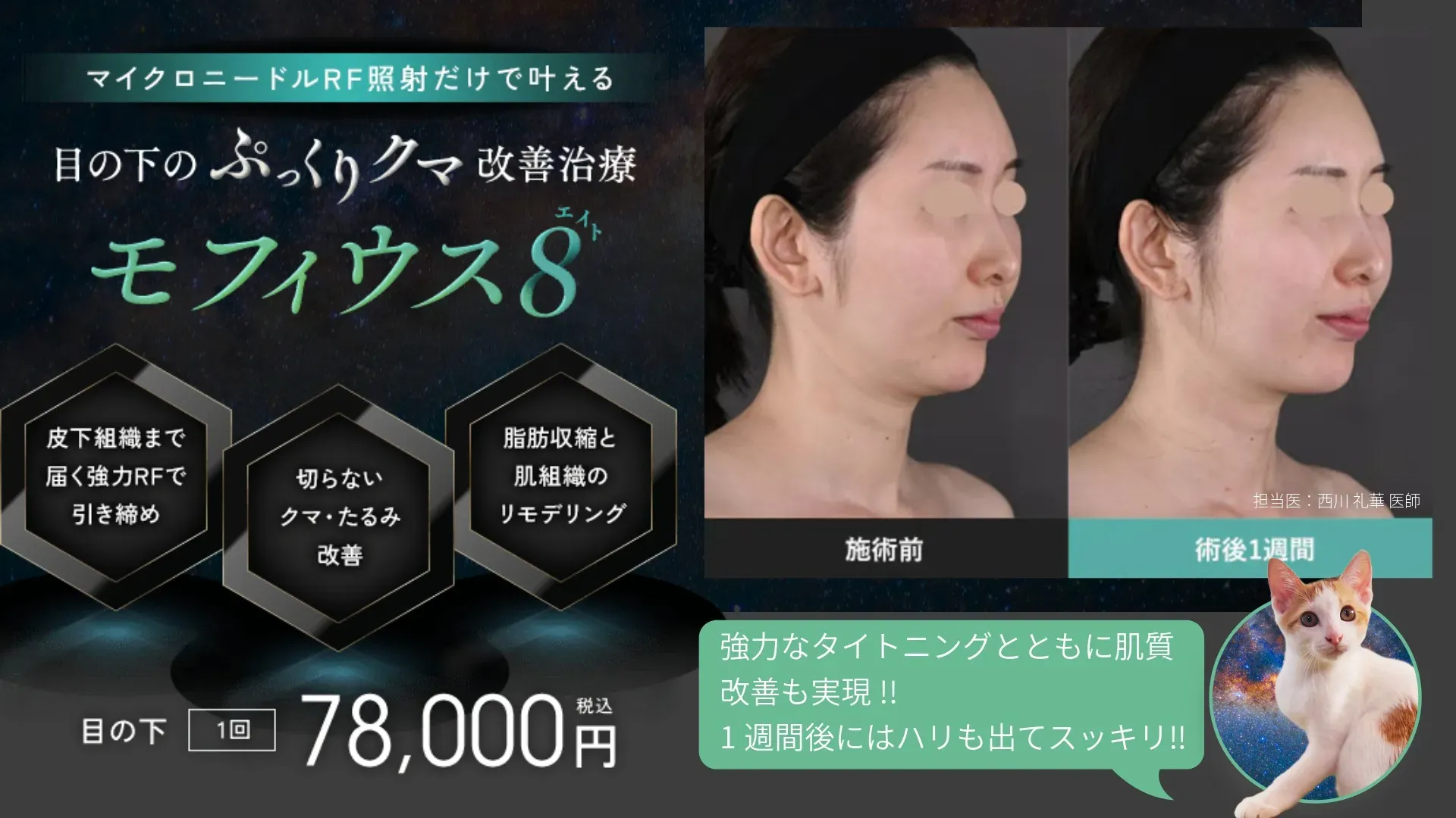 札幌でモフィウス8が安いおすすめの湘南美容クリニック 無料カウンセリングを実施