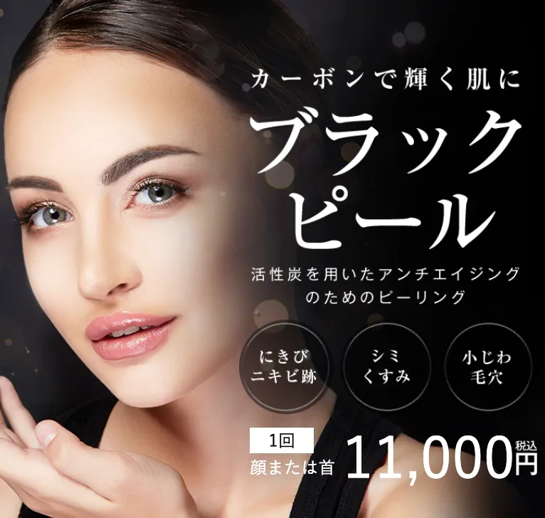 湘南美容クリニックのブラックピール