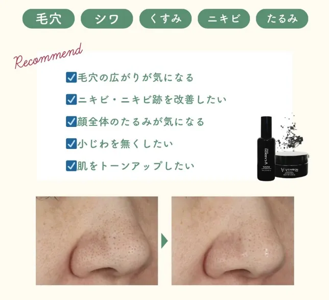湘南美容クリニックのブラックピールを推奨できる方