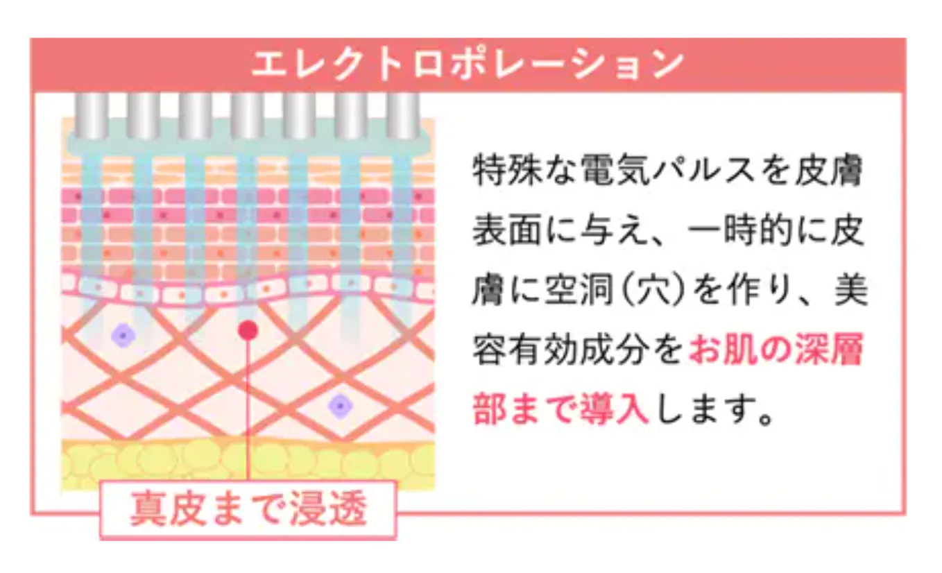 湘南美容クリニックのエレクトロポレーション（イオン導入）の口コミ評判 エレクトロポレーションの仕組み