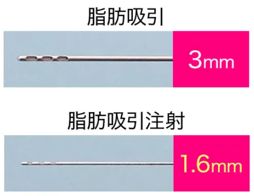 湘南美容クリニック（旧：湘南美容外科）の脂肪吸引注射で使用する注射針の太さ