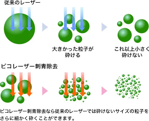 タトゥーの色素を微粒子まで分解し綺麗な仕上がりになる湘南美容クリニックのタトゥー除去