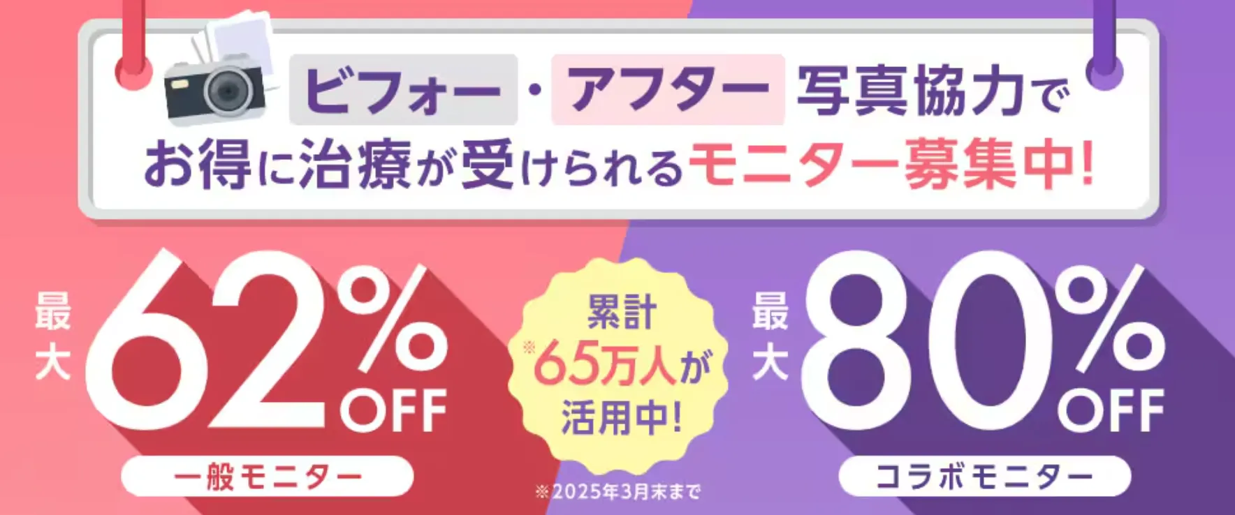湘南美容クリニックのモニター募集