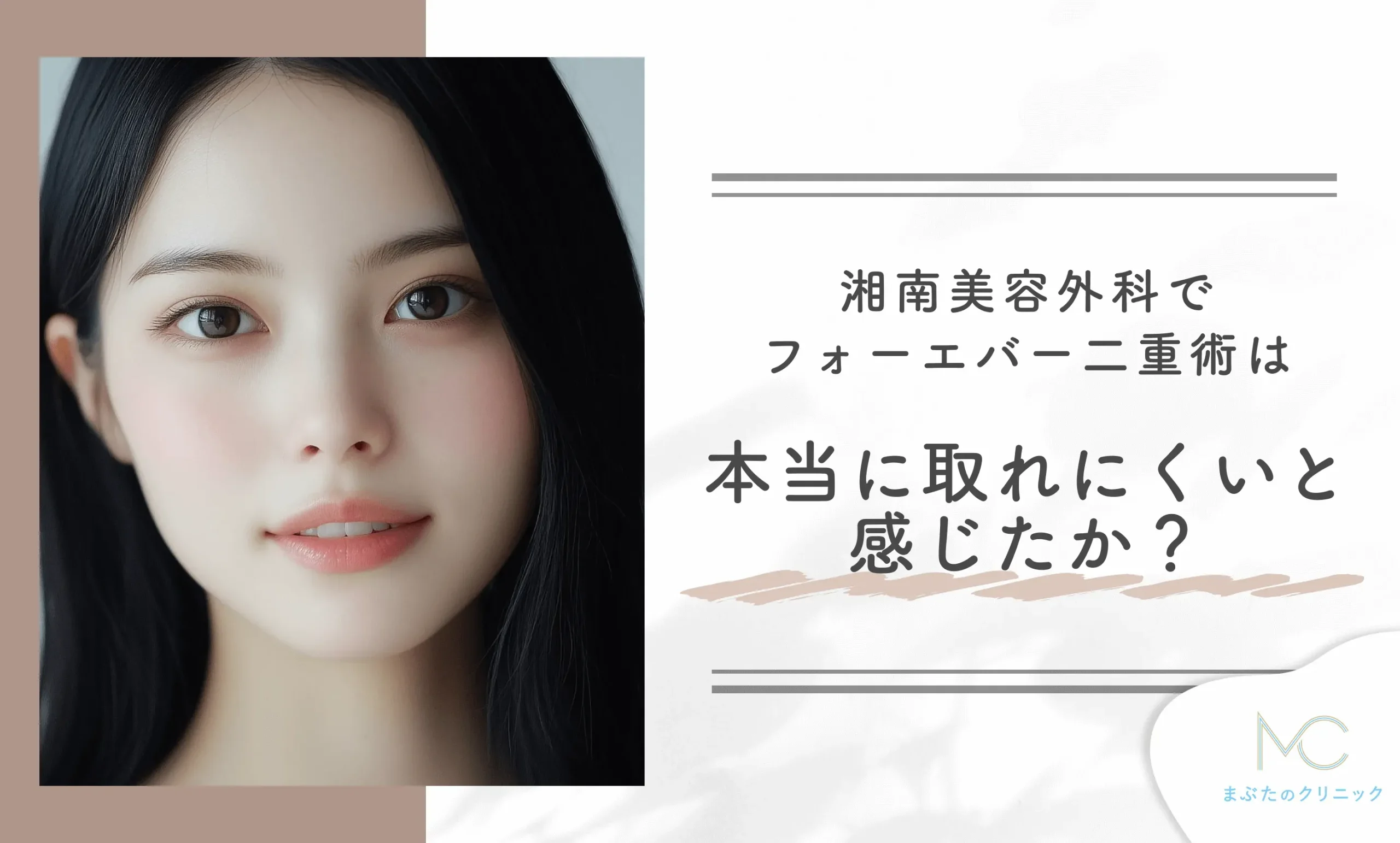 湘南美容外科でフォーエバー二重術は本当に取れにくいと感じましたか?