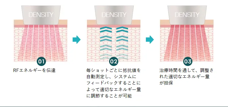 デンシティの仕組み