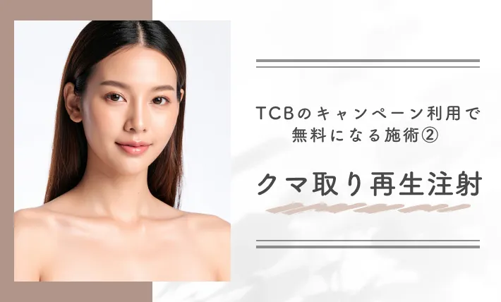 TCBのキャンペーン利用で無料になる施術② クマ取り再生注射
