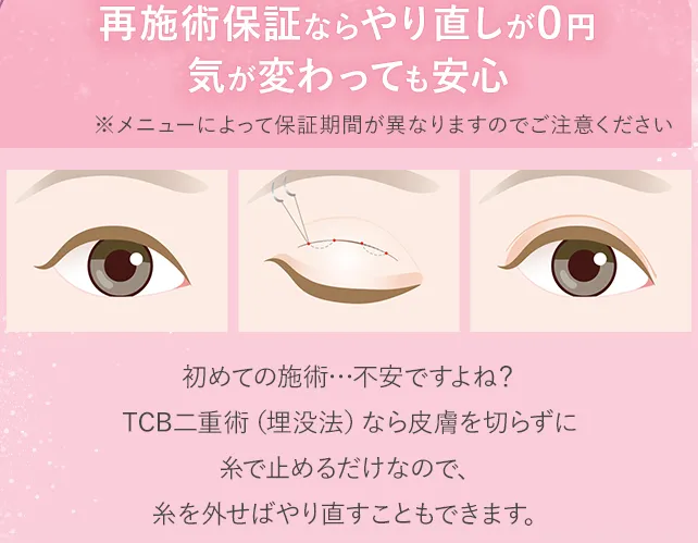 TCB二重整形再施術補償の画像