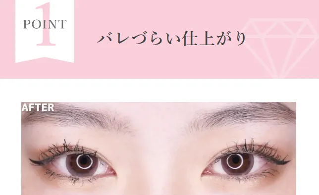 TCBの二重4,800円の口コミ評判!【いつまで受けられるのか調査】 バレづらい仕上がり