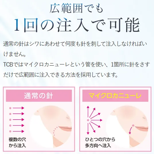 TCBのヒアルロン酸の注射は1回の注入で広範囲に効果