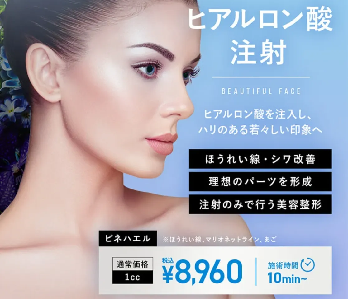 TCBのヒアルロン酸はほうれい線やシワ改善を注射のみで改善を目指せる
