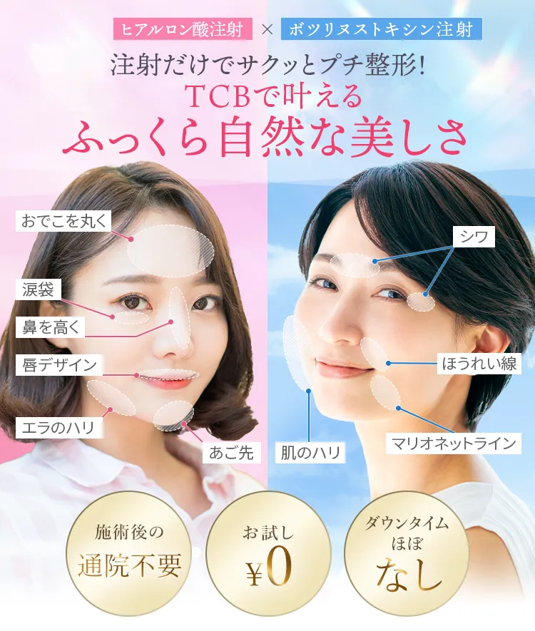 TCBのヒアルロン酸注入は失敗する?やり直し保証期間はあるのか調査 TCBのヒアルロン酸注射