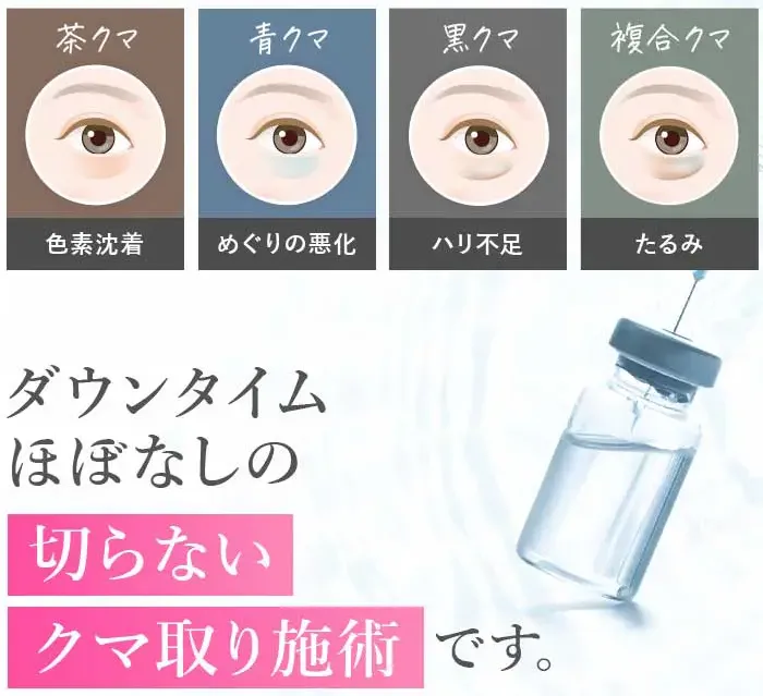 TCBのクマ取りの保証期間は？取り残しがあったらやり直しできるのか調査 | クマ取り再生注射とは？