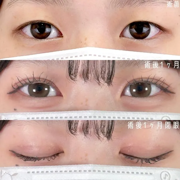 症例写真