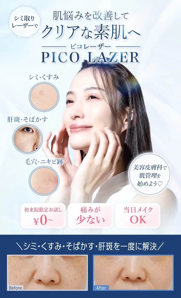 ピコレーザーがおすすめのTCBはクーポン利用で100%OFF