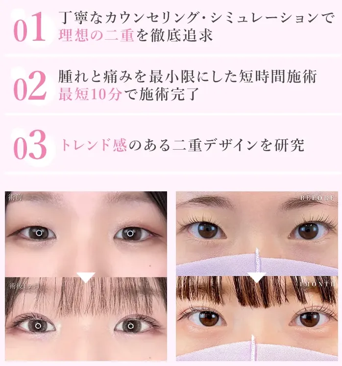 TCBの症例②