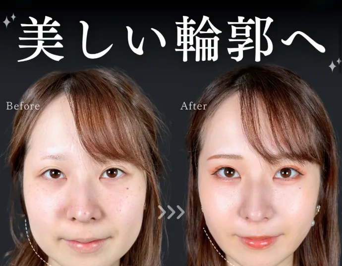 Tクリニック大見貴秀医師の口コミ評判・経歴 大見貴秀医師が施術した方の症例写真①