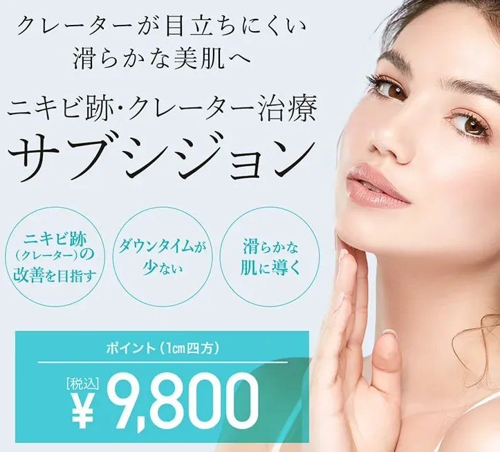 TCBのサブシジョンの価格