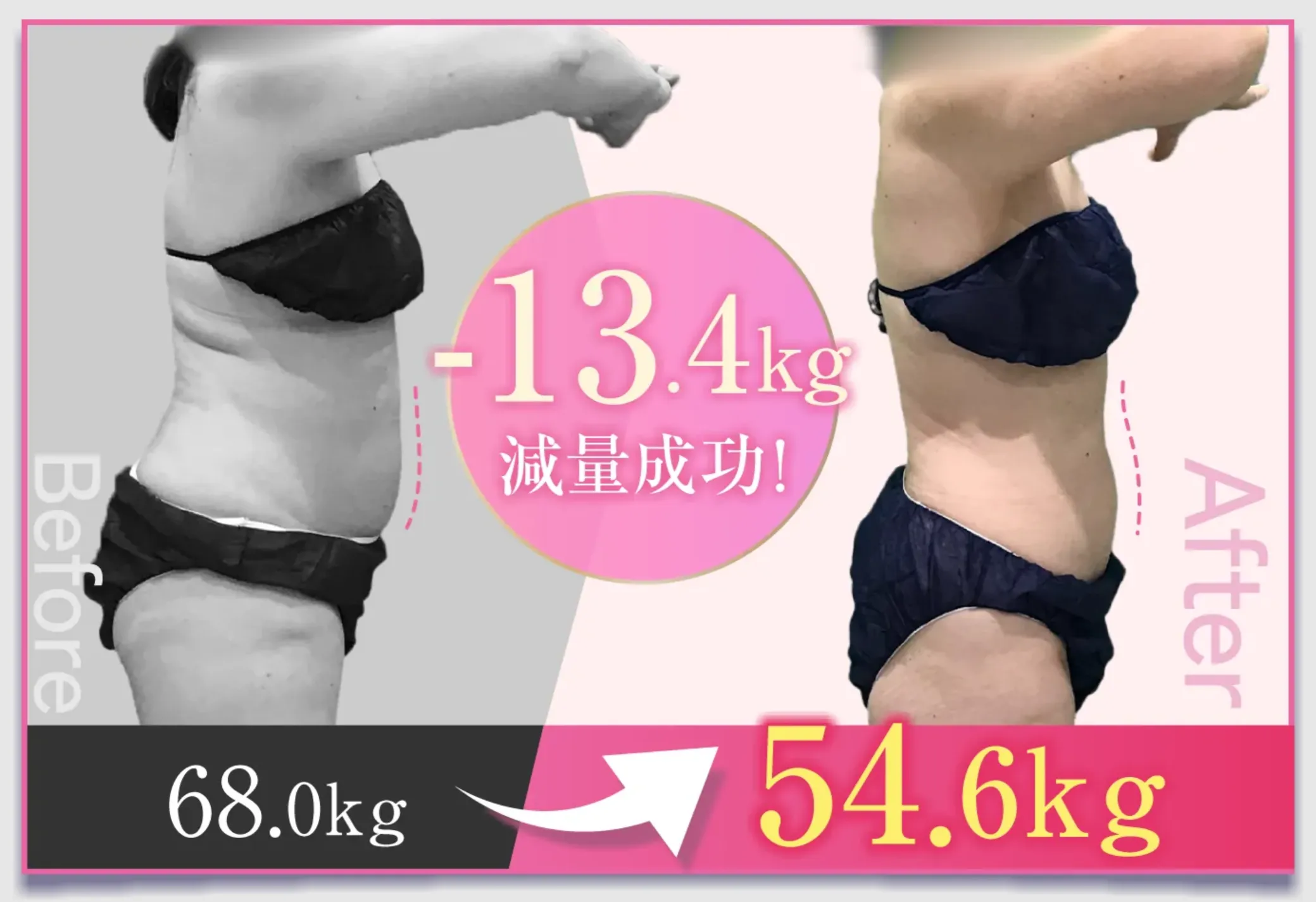 口コミで評判のURARAクリニックの無料モニター症例①