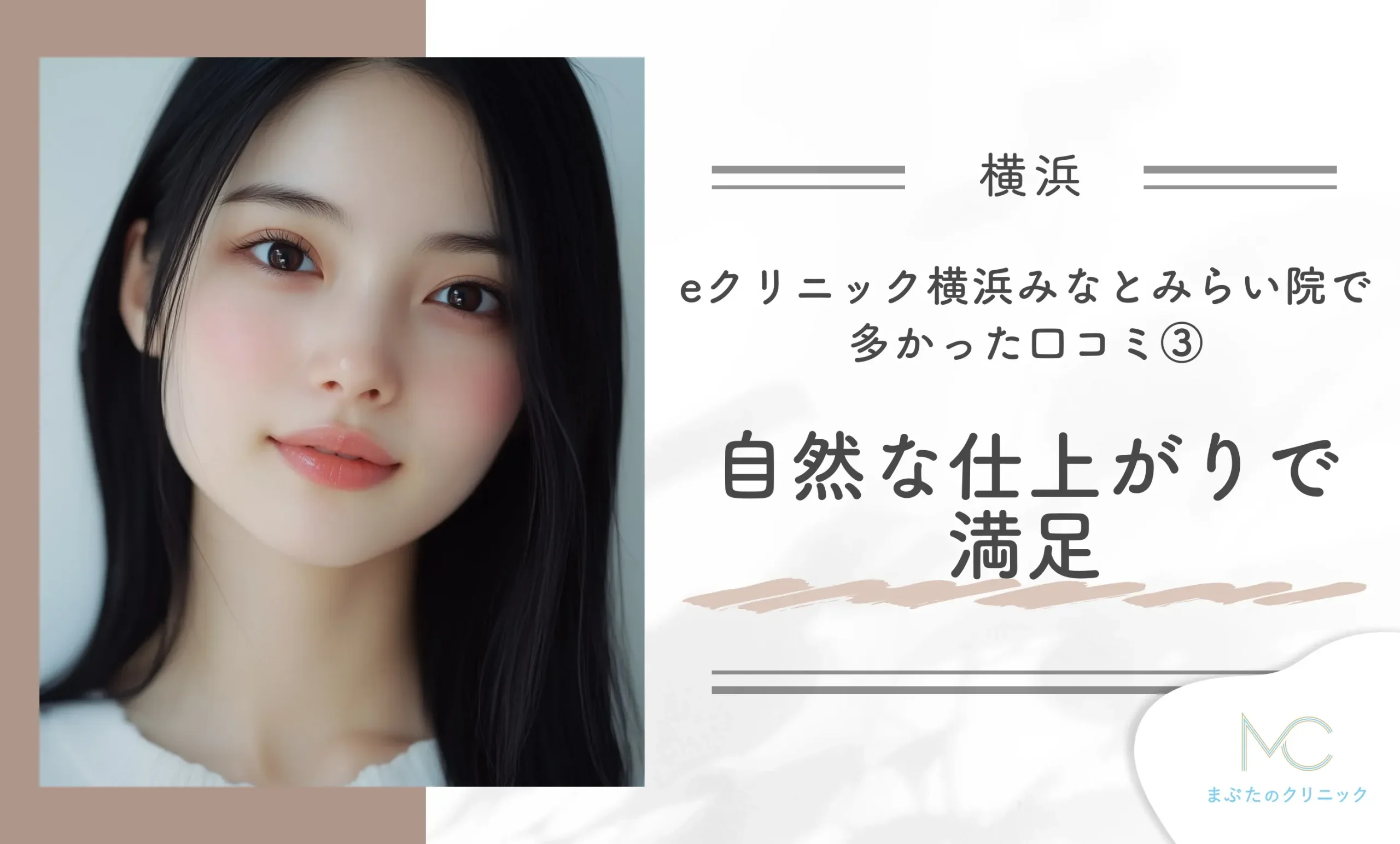 eクリニック横浜みなとみらい院で多かった口コミ③自然な仕上がりで満足