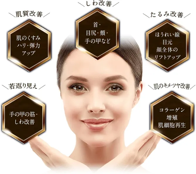 横浜でプロファイロが安いおすすめのクリニック 湘南美容クリニックの施術効果