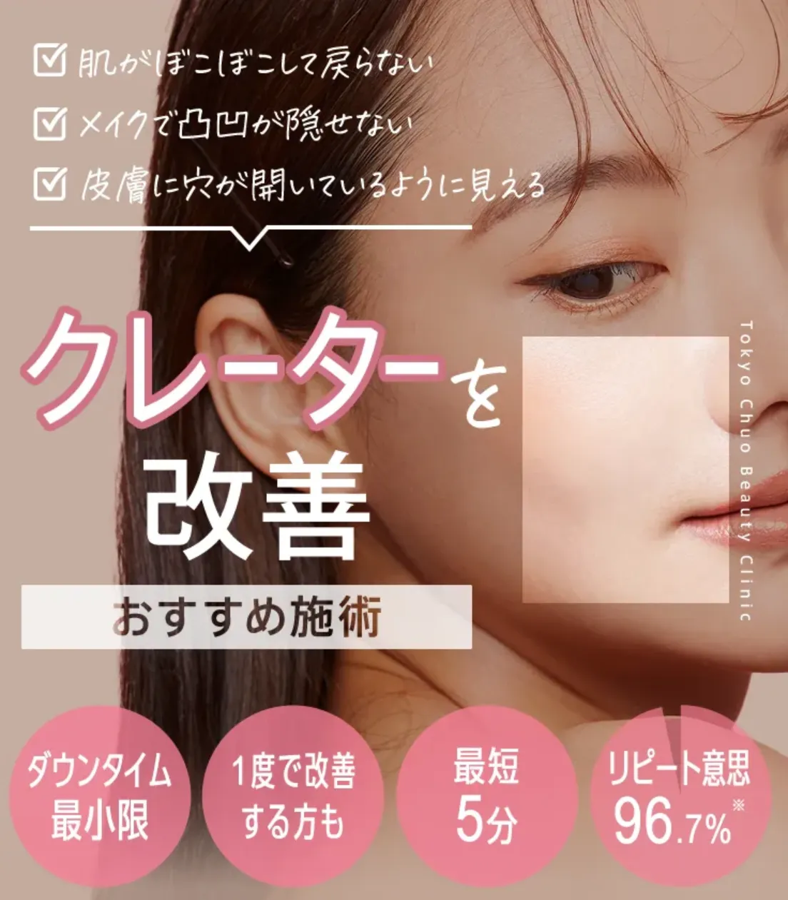 TCB東京中央美容外科のサブシジョン