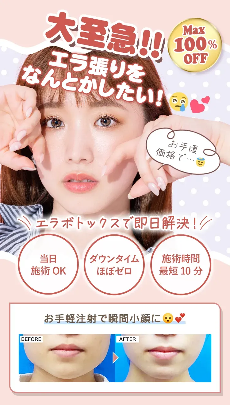 料金・値段がお手軽なTCBのボトックス施術について