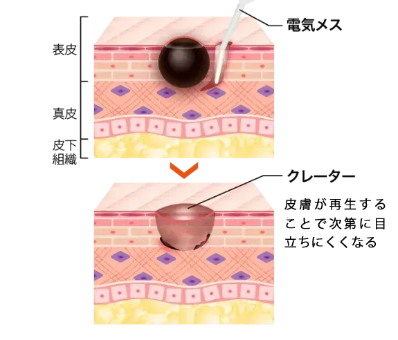 電気電解法のイメージ画像